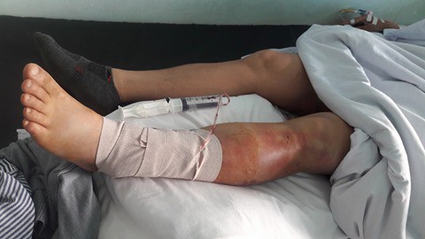 hai phong 5 thanh nien truy sat mot nguoi dan ong ngay giua ban ngay