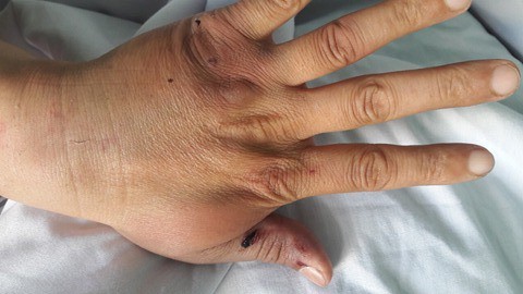 hai phong 5 thanh nien truy sat mot nguoi dan ong ngay giua ban ngay