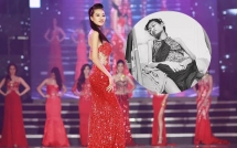 hhen nie dau xot truoc hinh anh da boc xuong cua nguoi mau 9x bi ung thu buong trung giai doan cuoi
