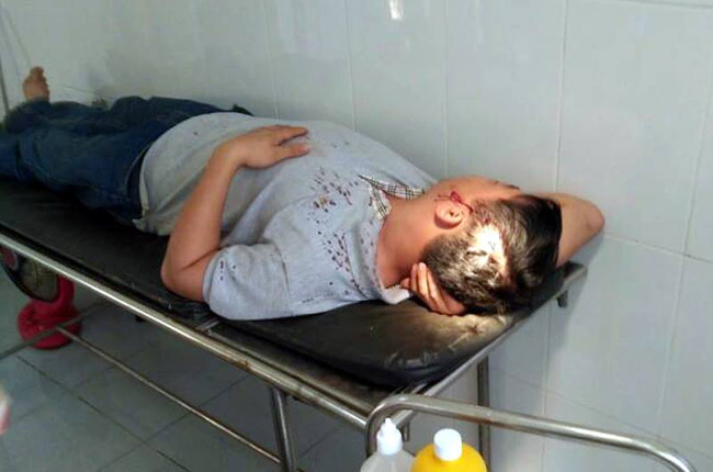 bi to thue xa hoi den danh phi cong tre vi khong dap ung nhu cau tinh duc nguoi phu nu 45 tuoi noi gi