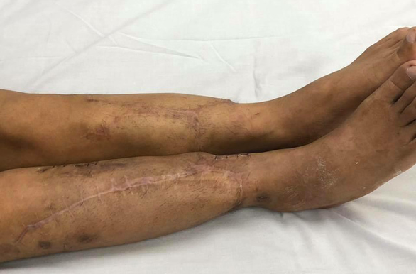 vi bac si tai nang hai lan tu choi troi au