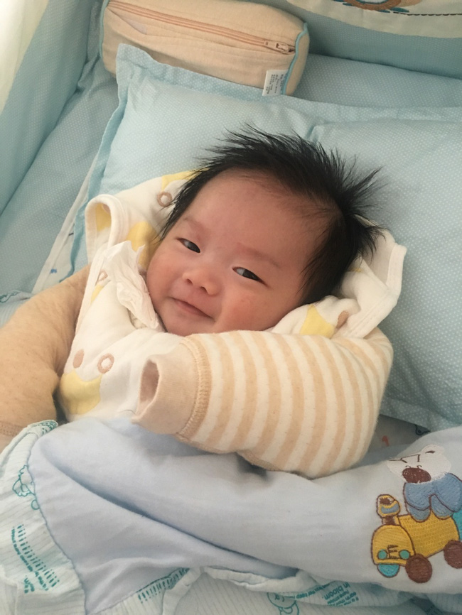 co gai mat 8 nam phau thuat giong pham bang bang roi cuoi luon bac si tham my cho minh
