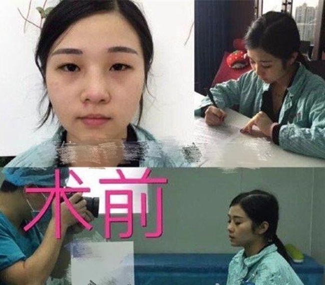 nhung co gai tre bat chap ca mang song de phau thuat tham my thanh ban sao cua than tuong