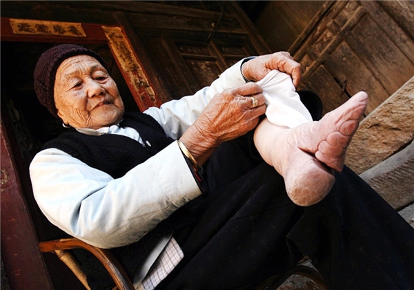 bo chan got sen khi cai gia cua sac dep la nhung doi chan ri mau va bien dang ca doi