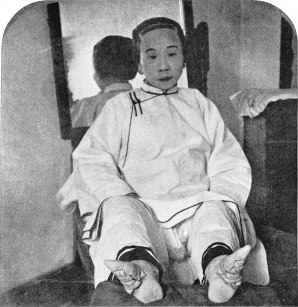 bo chan got sen khi cai gia cua sac dep la nhung doi chan ri mau va bien dang ca doi