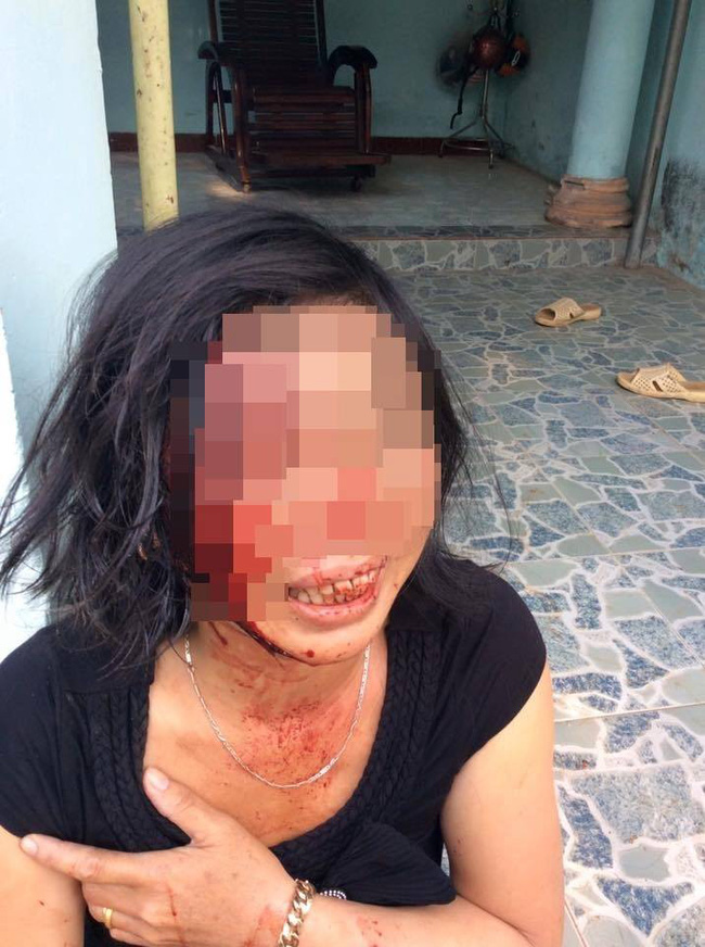 dong nai chong khoa trai cua danh vo tan nhan mau chay dam dia