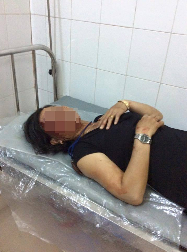 dong nai chong khoa trai cua danh vo tan nhan mau chay dam dia