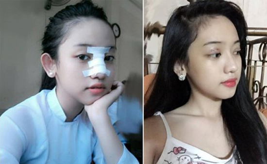 thuy vi tu ke thu ba den thi sinh the face
