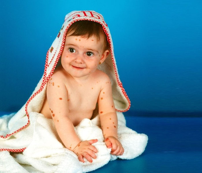 co gai nay tung bi treu choc tan nhan vi co 500 vet bot vay nhung hay nhin co ay o hien tai