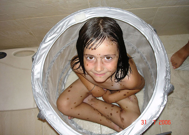 co gai nay tung bi treu choc tan nhan vi co 500 vet bot vay nhung hay nhin co ay o hien tai