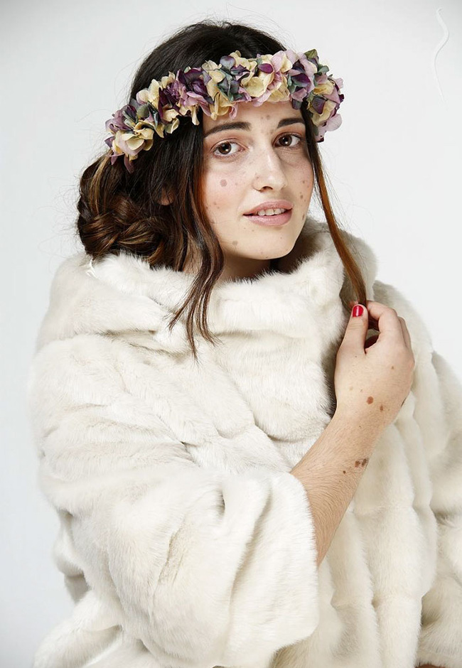 co gai nay tung bi treu choc tan nhan vi co 500 vet bot vay nhung hay nhin co ay o hien tai