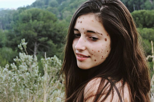 co gai nay tung bi treu choc tan nhan vi co 500 vet bot vay nhung hay nhin co ay o hien tai