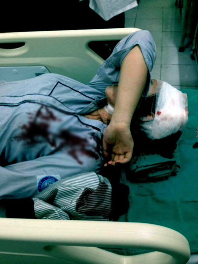 ha noi kinh hoang nu sinh lop 10 bi 3 thanh nien dung tuyp sat tan cong