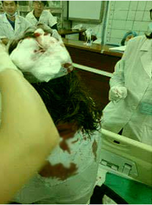 ha noi kinh hoang nu sinh lop 10 bi 3 thanh nien dung tuyp sat tan cong