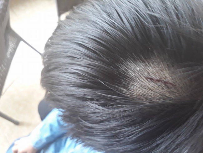 tran tinh cua co giao dung thuoc danh vao dau 25 hoc sinh tieu hoc o nghe an