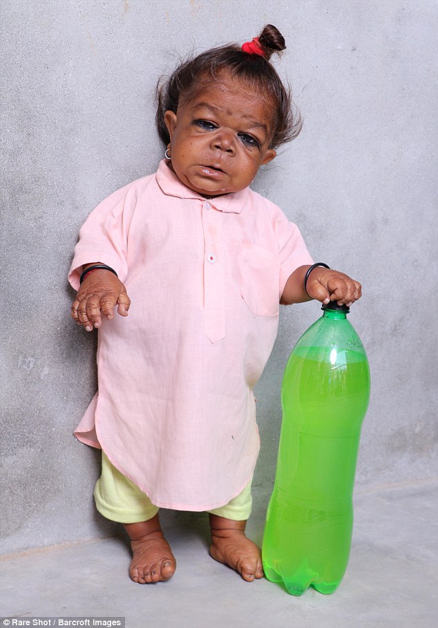 21 tuoi ma chi cao 58cm nam thanh nien duoc dan lang ton tho vi nghi do la hien than cua than hindu