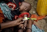 it nhat 26 nguoi chet doi o somalia chi trong hon 1 ngay