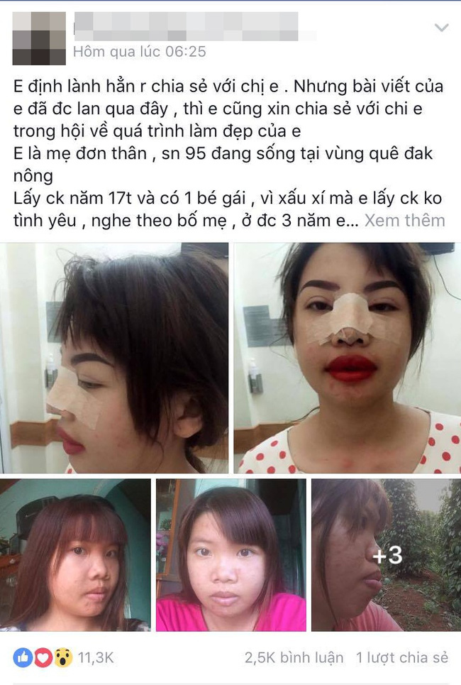 bi ban be xa lanh vi ngoai hinh xau xi ba me don than o dak nong quyet dap mat lam lai