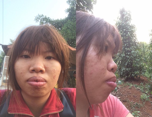bi ban be xa lanh vi ngoai hinh xau xi ba me don than o dak nong quyet dap mat lam lai