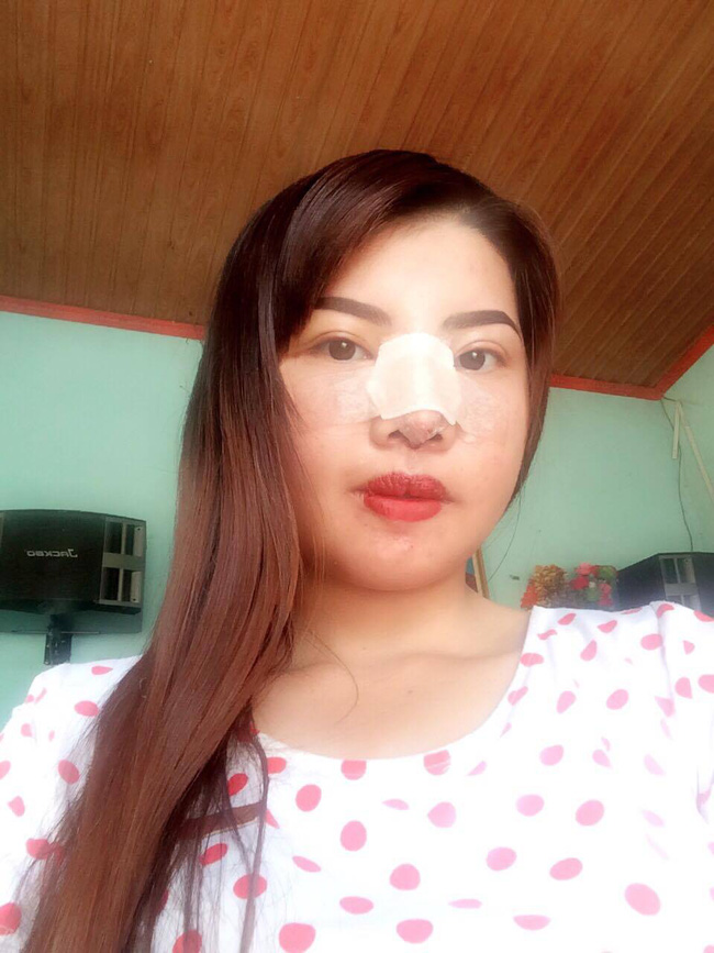 bi ban be xa lanh vi ngoai hinh xau xi ba me don than o dak nong quyet dap mat lam lai