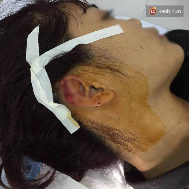 giao vien day khieu vu the thao to bi phu huynh hoc sinh cu can dut tai