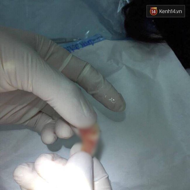 giao vien day khieu vu the thao to bi phu huynh hoc sinh cu can dut tai