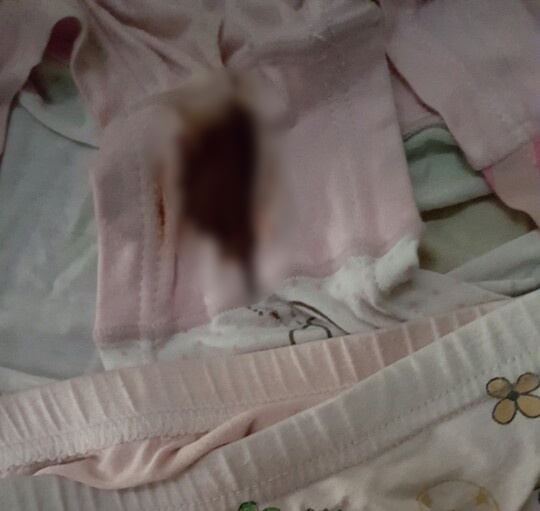 vu be gai lop 1 nghi bi xam hai o thu duc me be de nghi chuyen ho so dieu tra len cong an tphcm