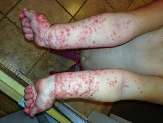 day la li do bo me nhat dinh phai tam rua cho con sau khi di choi cong vien khong phai ai cung may man