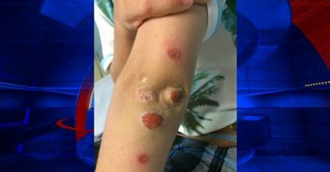 day la li do bo me nhat dinh phai tam rua cho con sau khi di choi cong vien khong phai ai cung may man