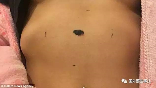 co gai tre may man thoat chet chi nho viec khoe mot buc anh mac bikini tren mang xa hoi