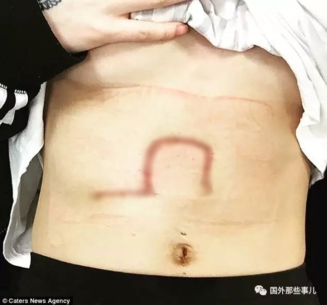 co gai tre may man thoat chet chi nho viec khoe mot buc anh mac bikini tren mang xa hoi