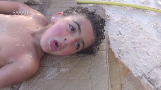 hinh anh dau long ve nhung dua tre la nan nhan trong cuoc chien hoa hoc tai syria