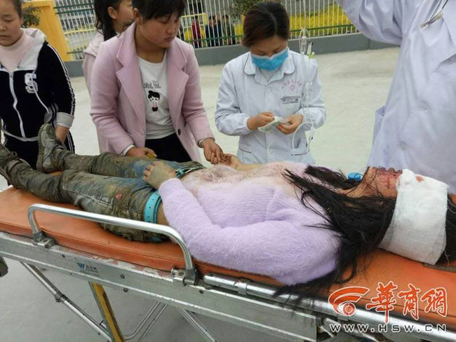 nu sinh trung hoc bi ke hiep dam tan cong den mu mat tren duong di hoc