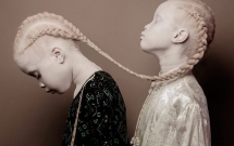 ve dep la cua cap chi em song sinh bi bach tang gay xon xao nganh cong nghiep thoi trang brazil