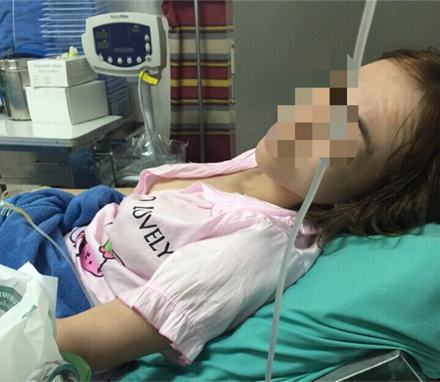 chuan bi tien hanh ca phau thuat chuyen gioi dau tien tai viet nam