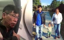 xac nhan bac si chau a bi loi khoi may bay united airlines la nguoi goc viet