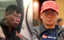 cong dong len tieng benh vuc bac si goc viet sau khi cau chuyen qua khu cua ong bi loi ra mo xe