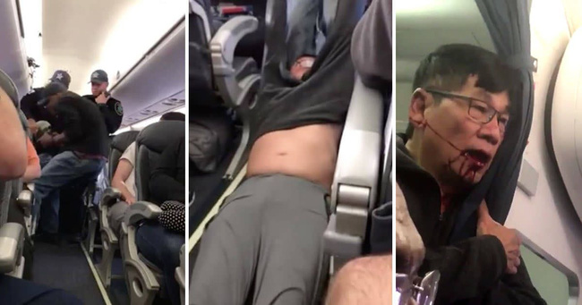 ceo united airlines gui loi xin loi moi sau khi nhan xet bac si goc viet la phien phuc va hieu chien