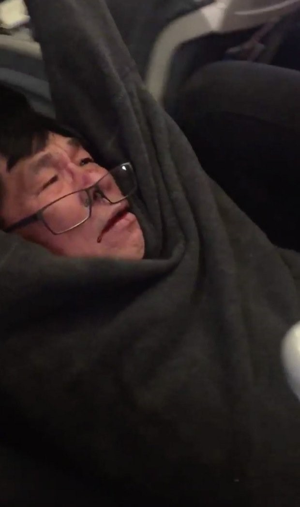 bac si goc viet co du co so phap ly de thang kien united airlines hang trieu usd