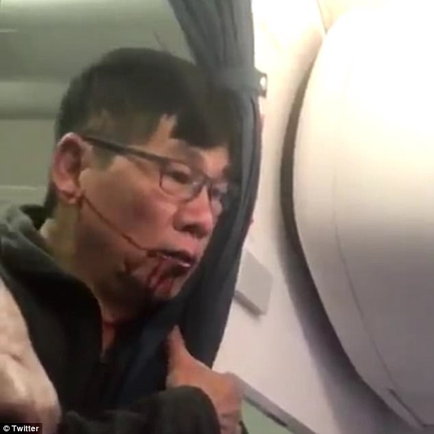 chan dung 2 luat su hang dau dai dien cho bac si goc viet trong vu kien voi united airlines