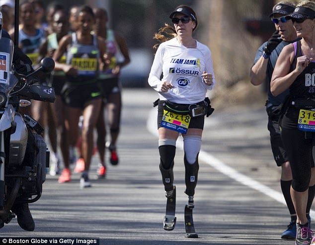 nguoi phu nu cut hai cang chan mang y chi sieu nhan