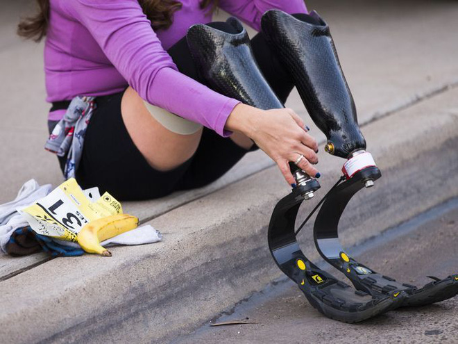 nguoi phu nu cut hai cang chan mang y chi sieu nhan