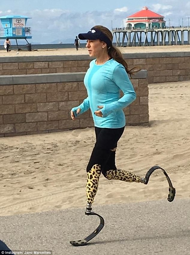 nguoi phu nu cut hai cang chan mang y chi sieu nhan