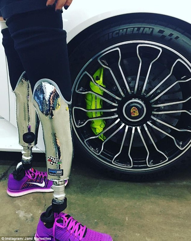 nguoi phu nu cut hai cang chan mang y chi sieu nhan