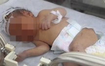 day la vat dung vo cung nguy hiem nha nao cung co tre em khong kheo dung vao mat mang nhu choi