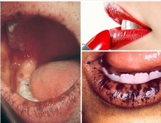 giam doc bv da lieu tw me bau dung son moi nhiem doc chi con de mac bien chung tam than di dang