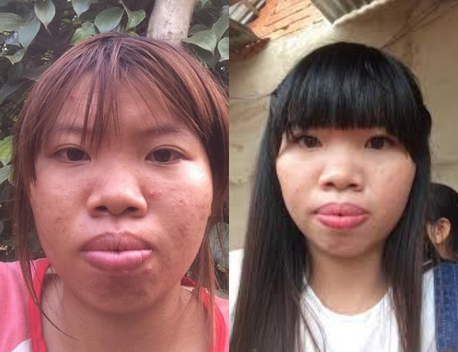 lot xac sau tham my co gai tung bi goi la thi no tai sinh muon tham gia chuong trinh hen ho de tim mot nua cua minh