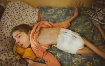 khong chi rieng syria van nan suy dinh duong cung dang xay ra ngay tai mot quoc gia chau au