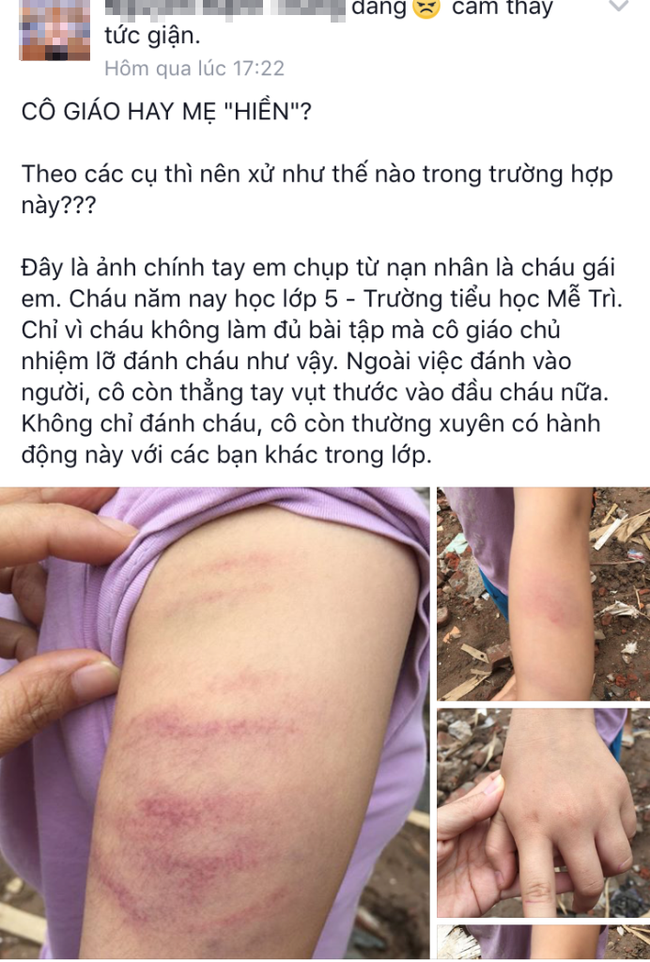 ha noi co giao chu nhiem dung thuoc danh bam tim tay hoc sinh vi khong hoc bai