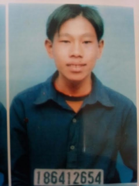 hon 10 nam tron sang lao nam thanh nien sa luoi chi vi not ruoi o mep phai